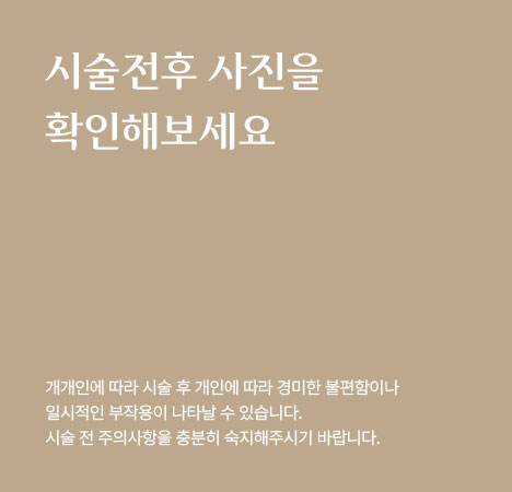 시술전후 사진을 확인해보세요.