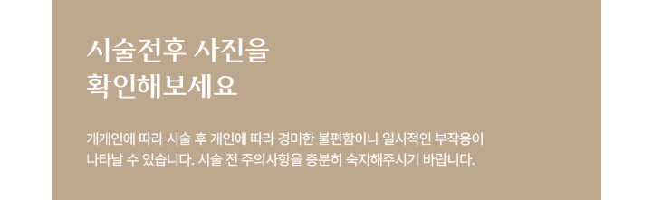 시술전후 사진을 확인해보세요.