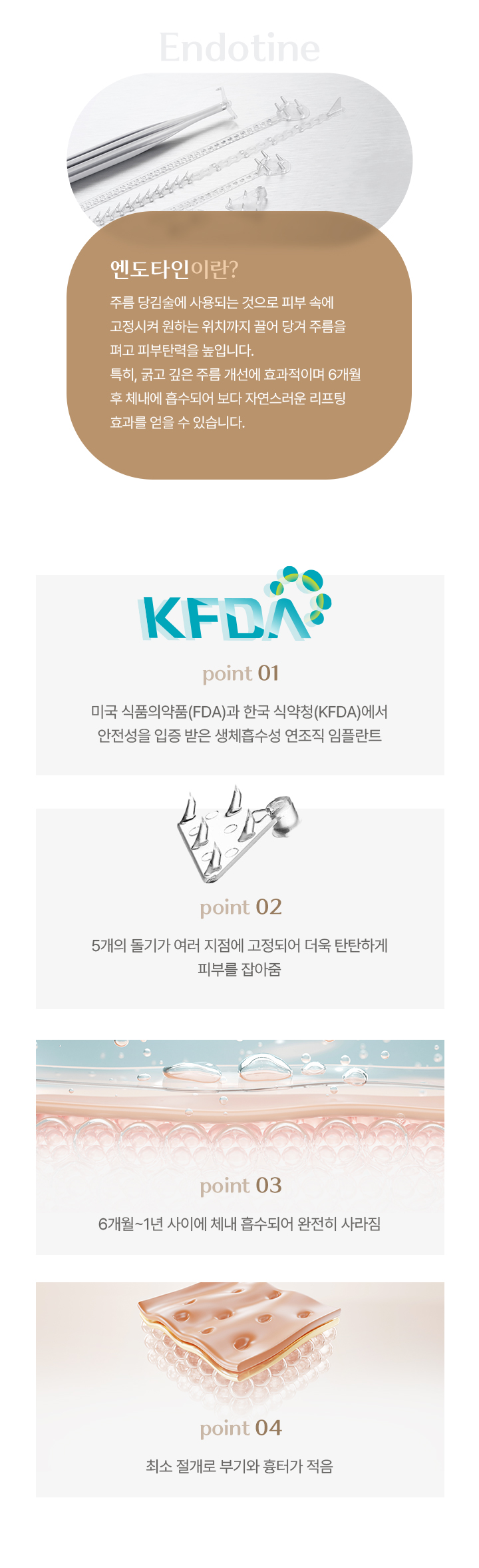 시술방법