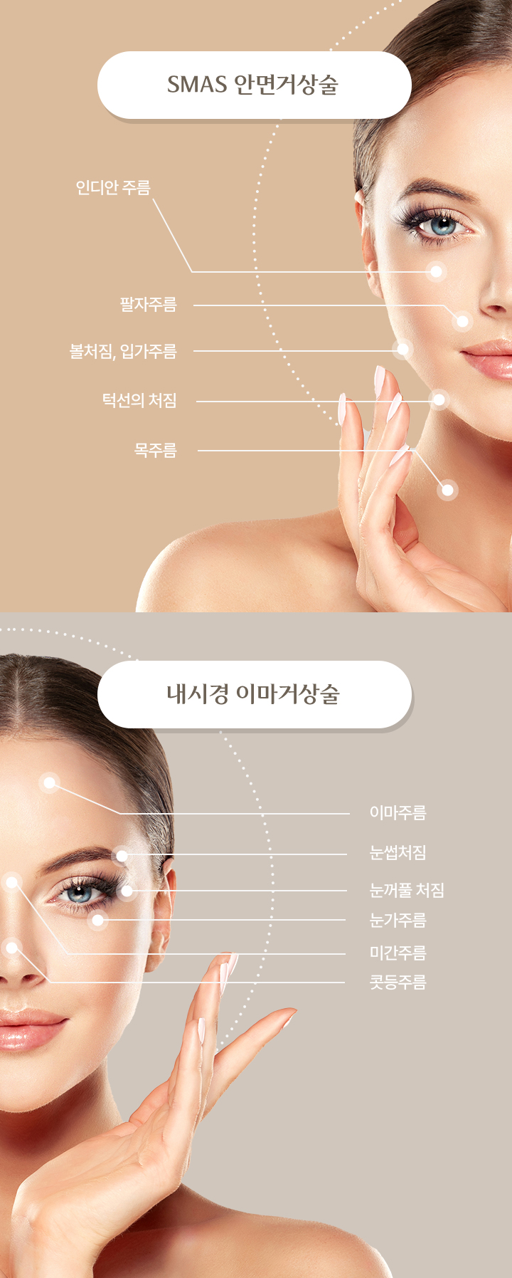 SMAS안면거상술