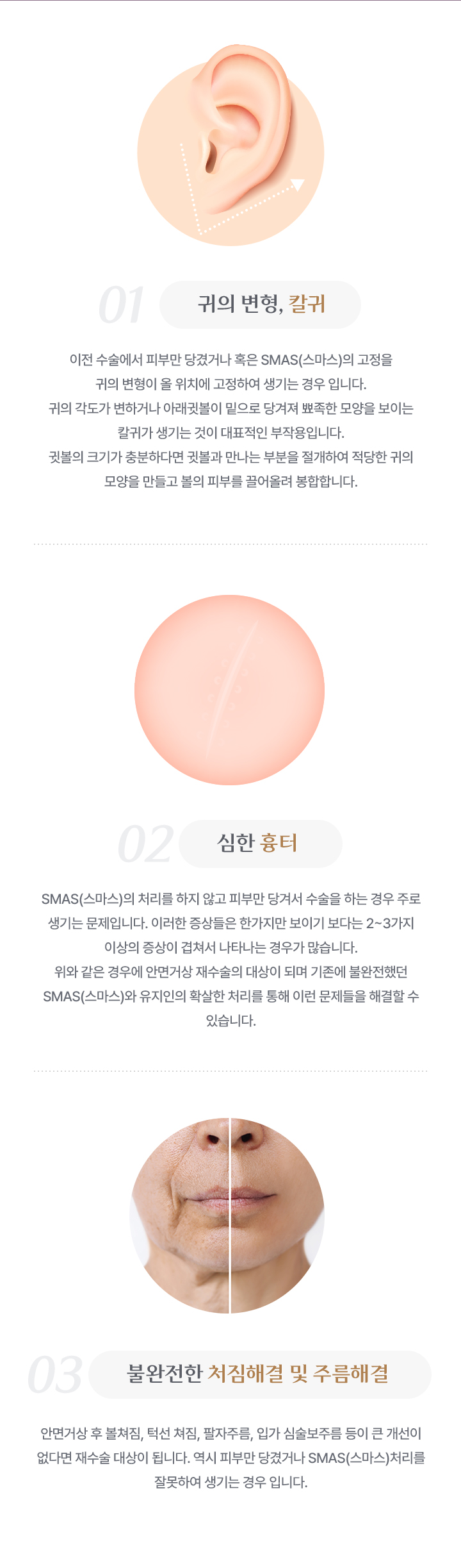 귀의 변형, 칼귀