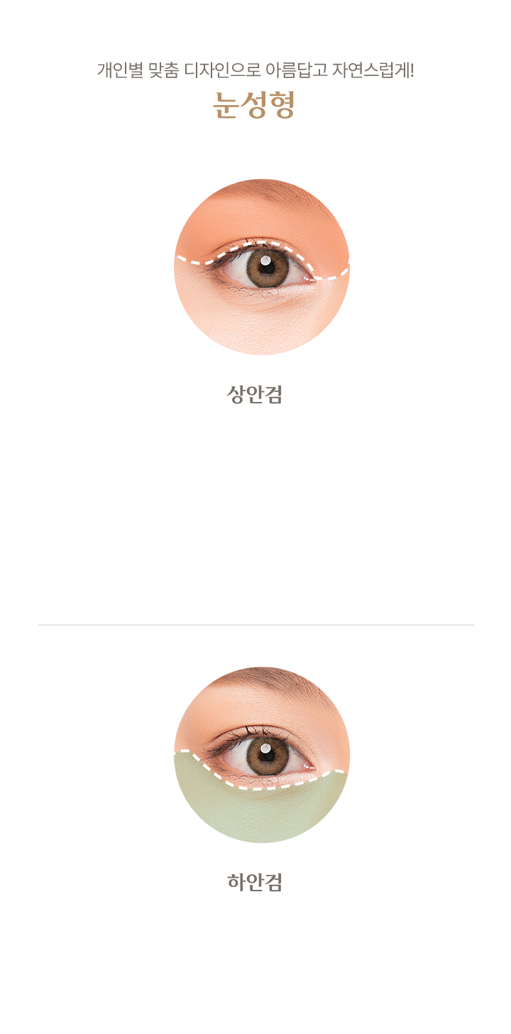 눈성형