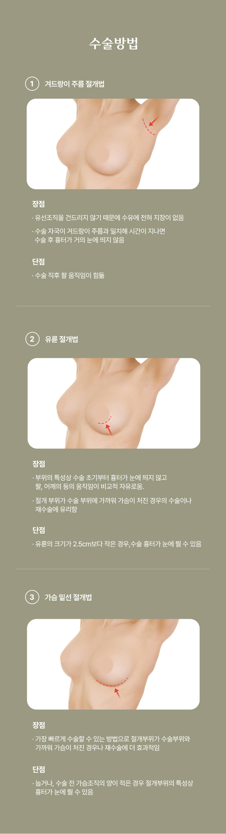 가슴 수술방법 