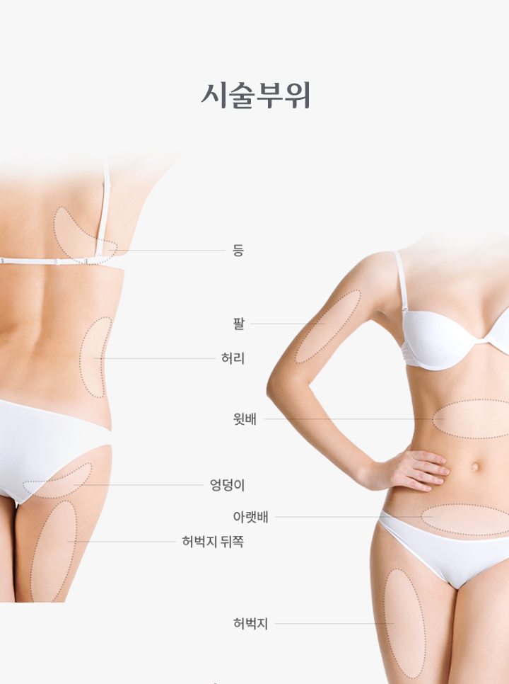 지방흡입 시술부위