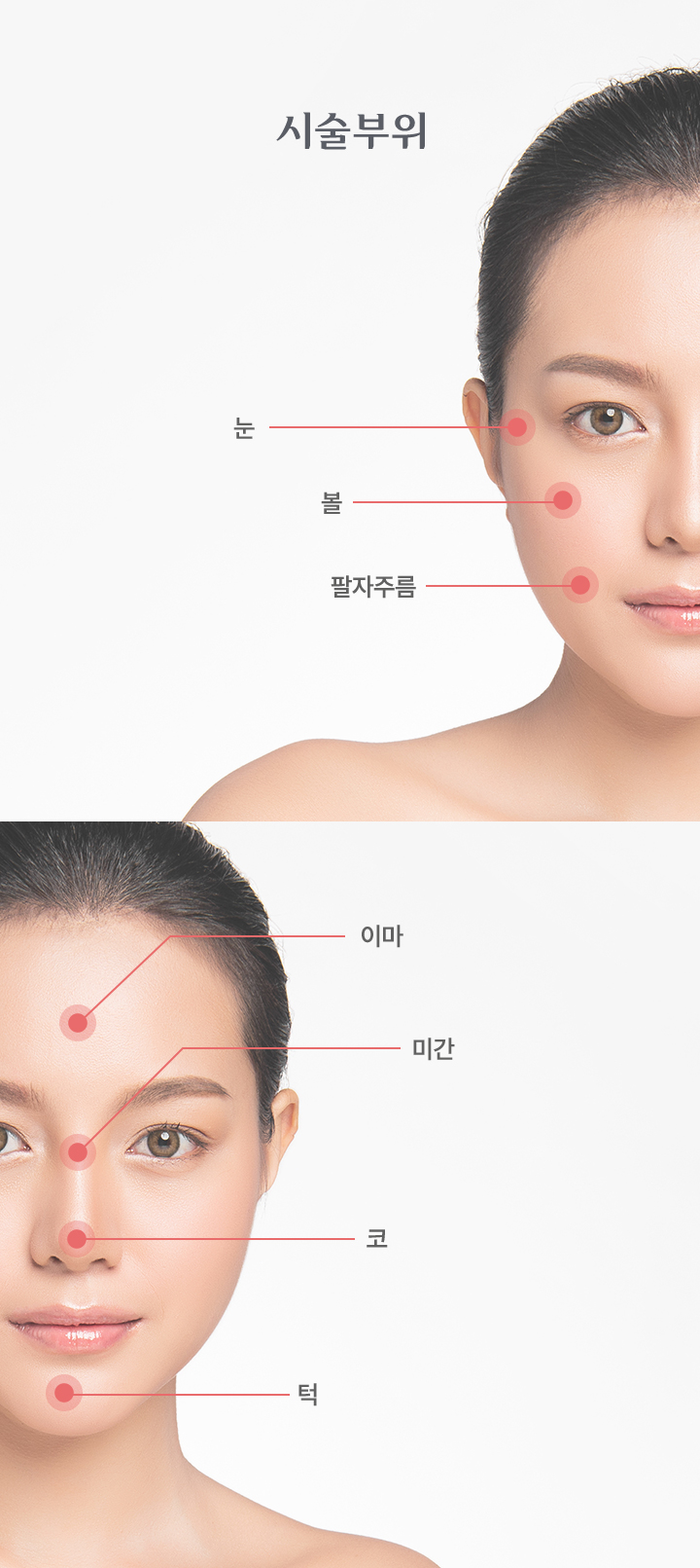 지방이식 시술부위