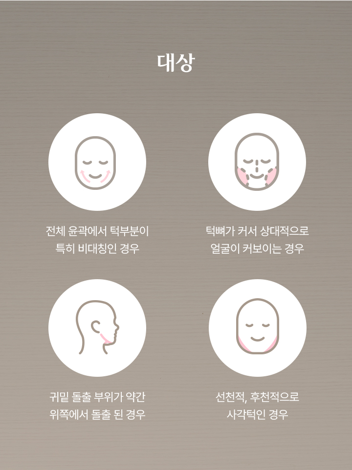 턱성형술 대상