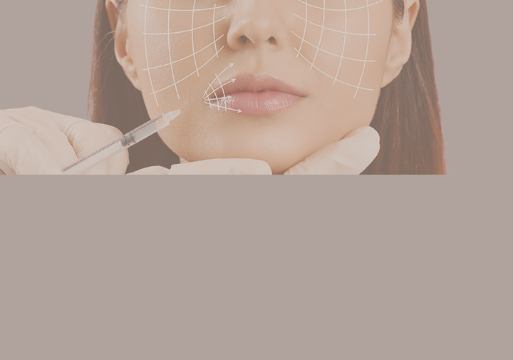 필러란?
