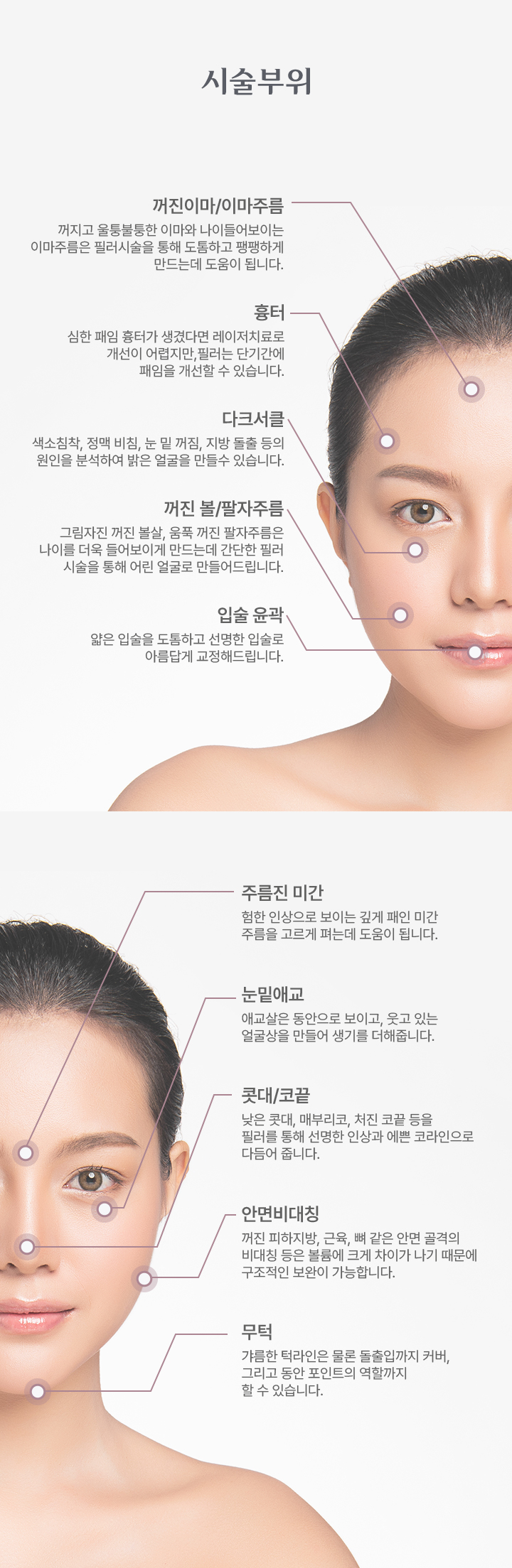 필러 시술방법 