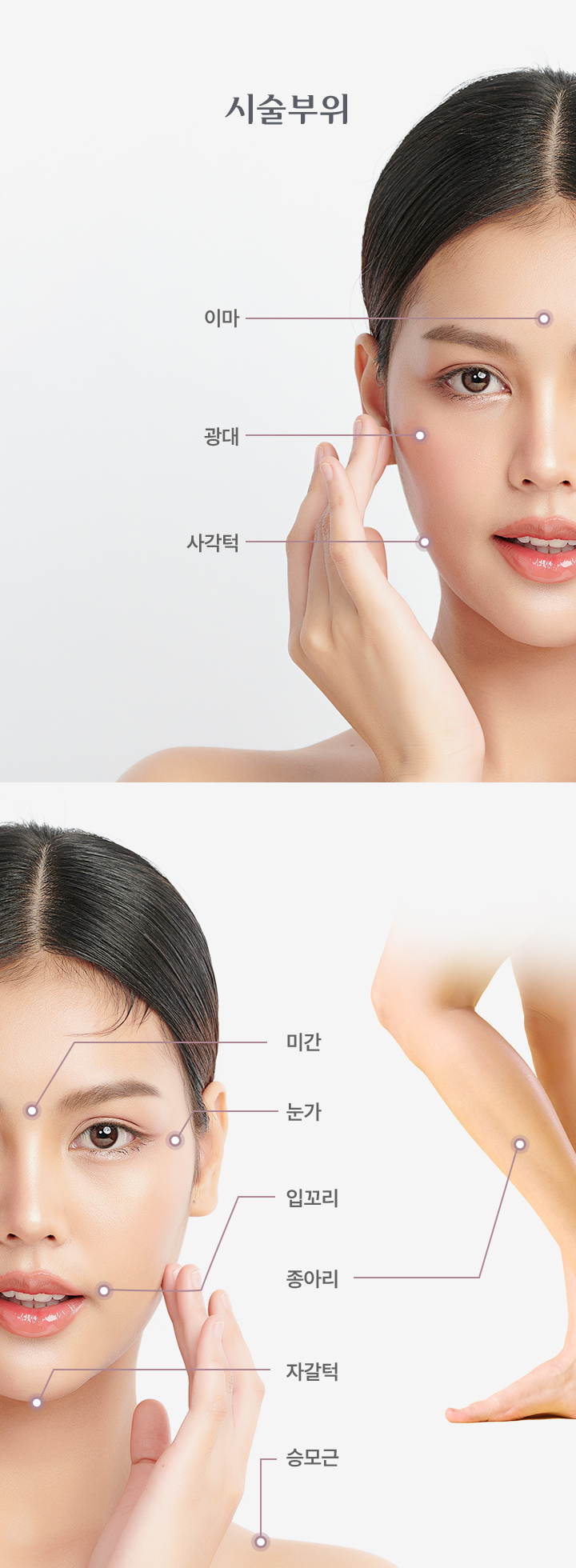 보톡스 시술부위 