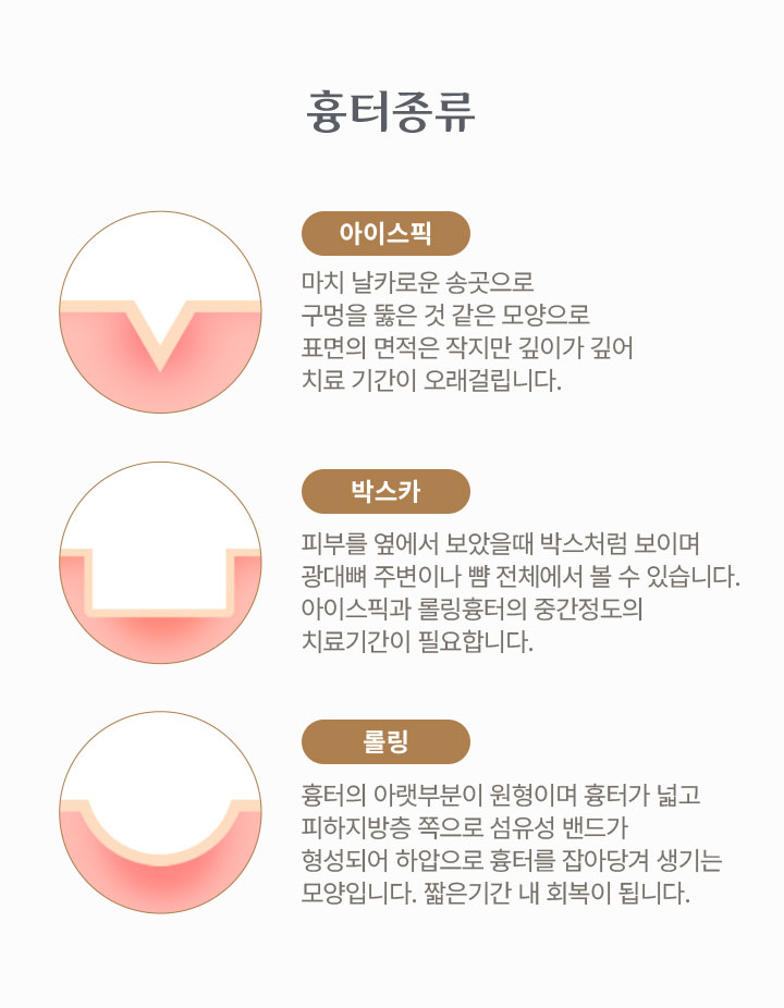 흉터종류