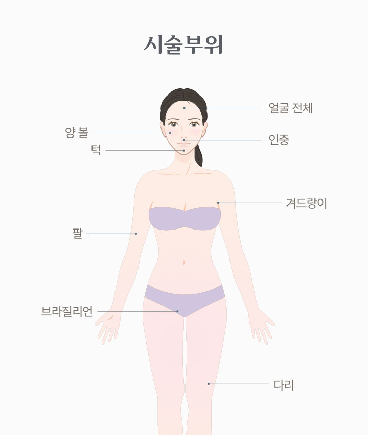 시술 부위