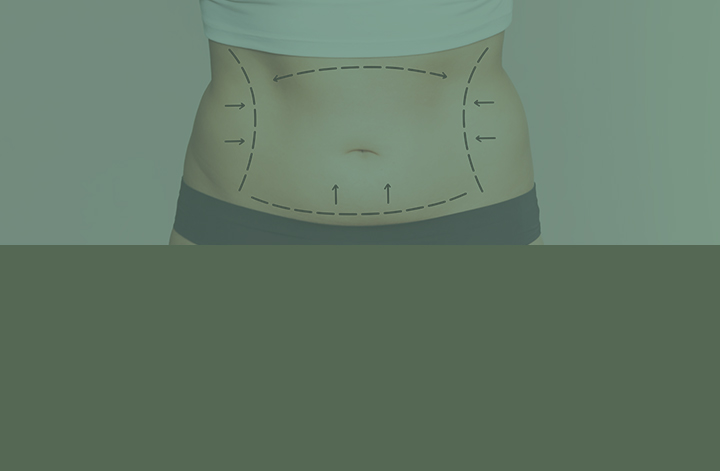 미용, 다이어트주사란?