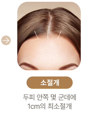 소절개