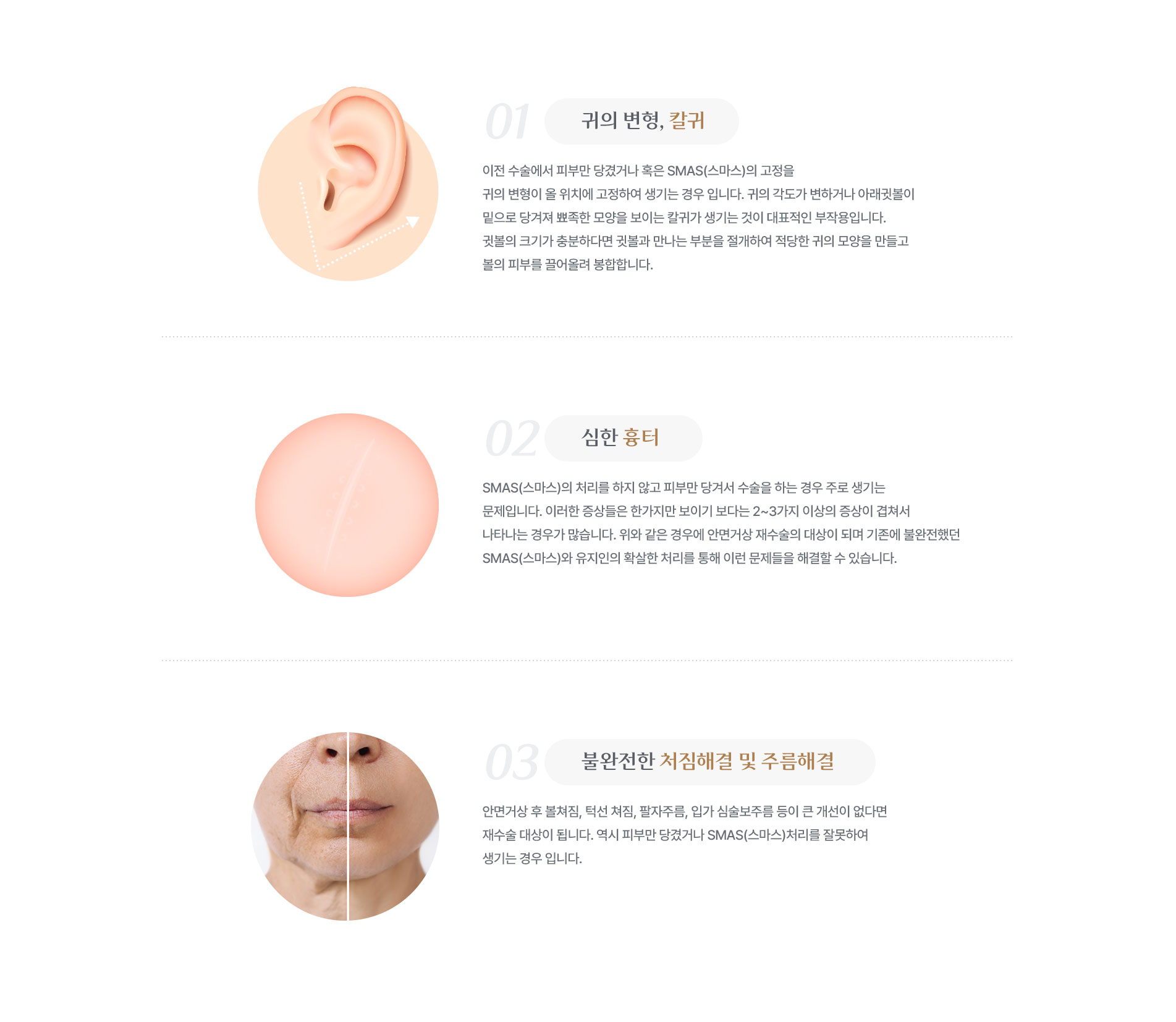 귀의 변형, 칼귀