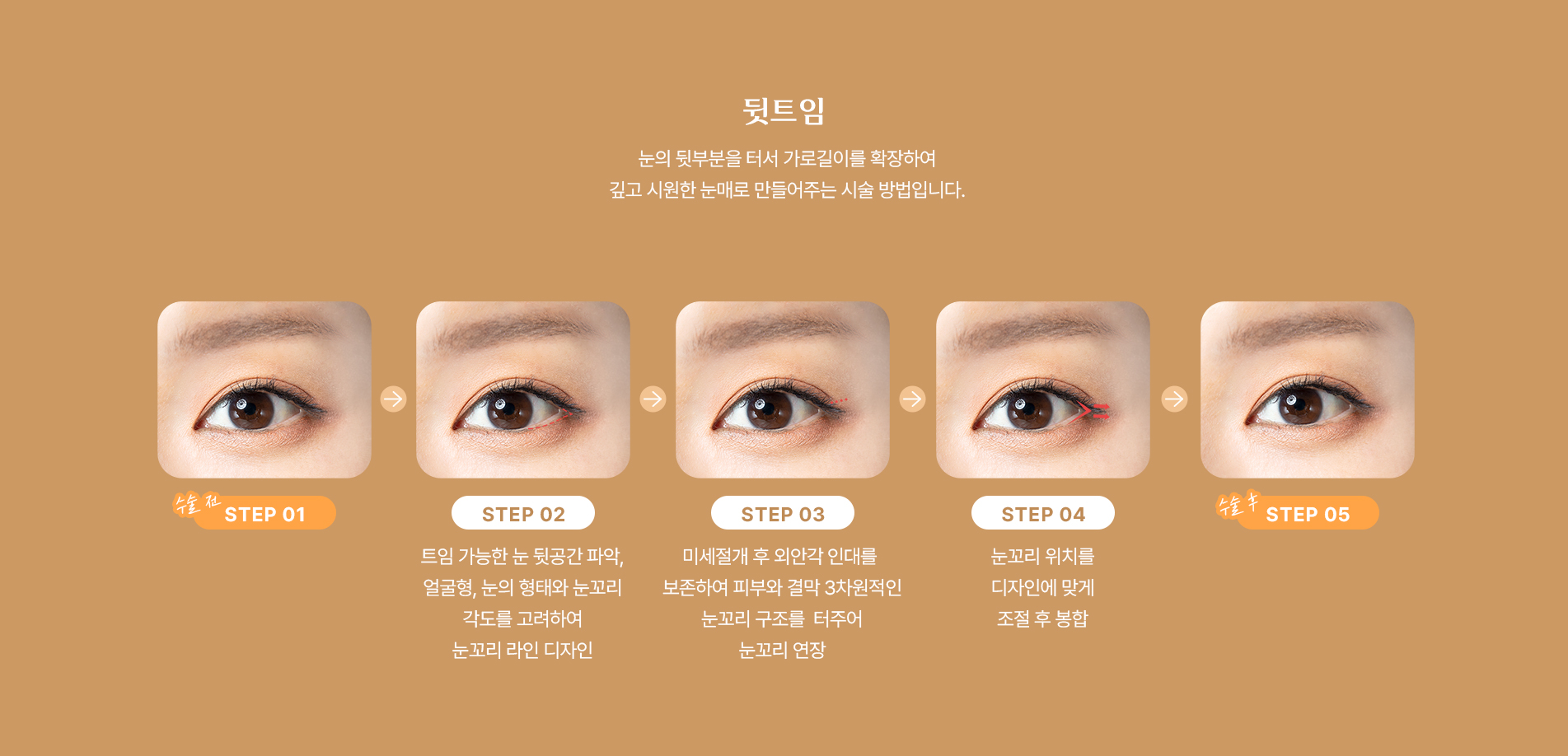 뒷트임