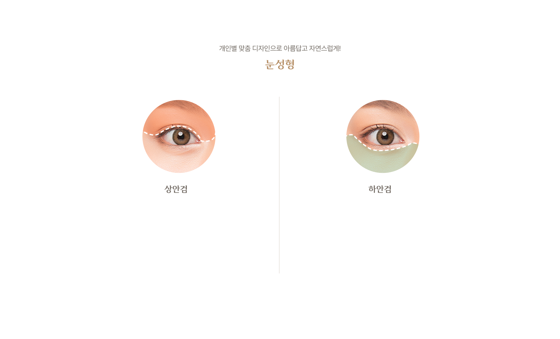 눈성형