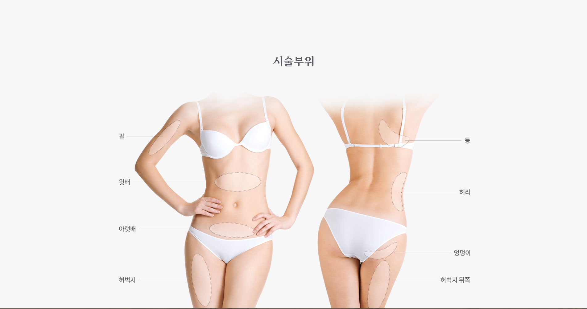 지방흡입 시술부위