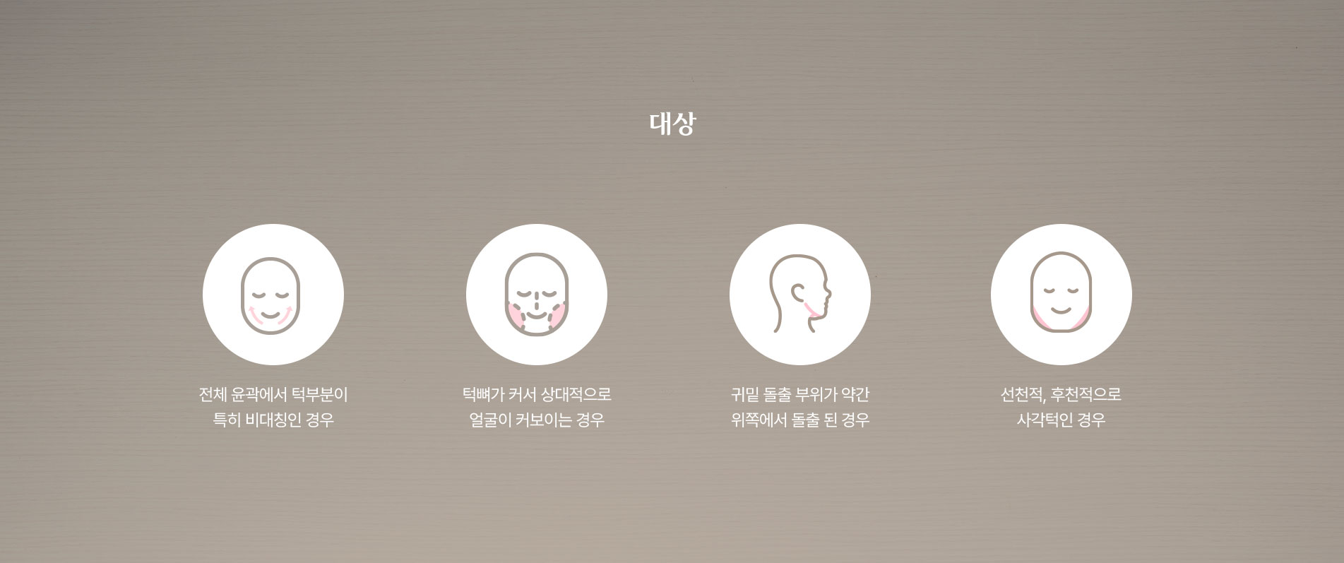 턱성형술 대상