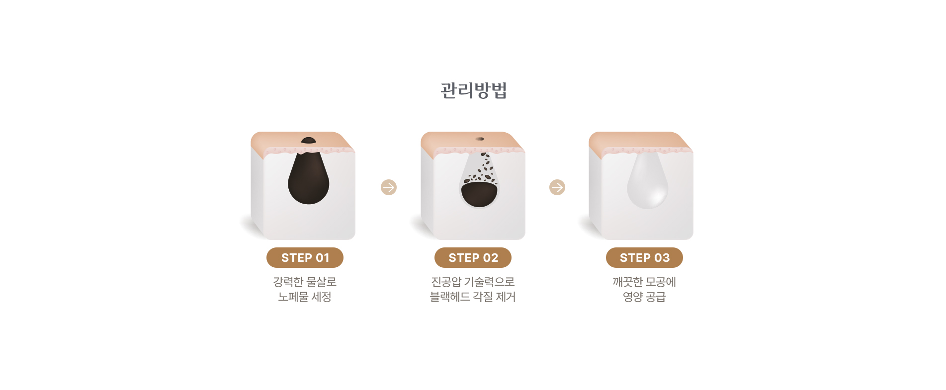 관리방법 