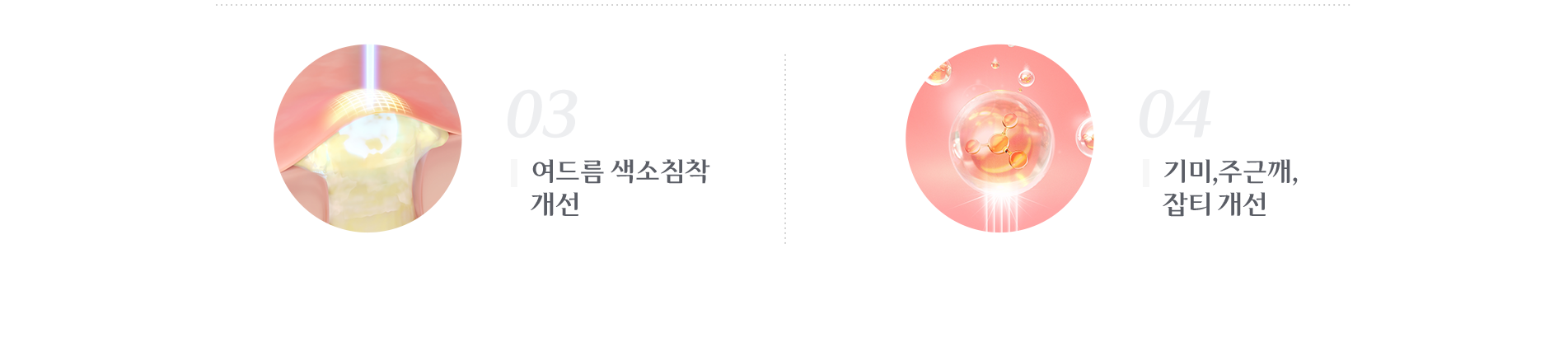 여드름 색소침착 개선, 기미/주근깨/잡티 개선
