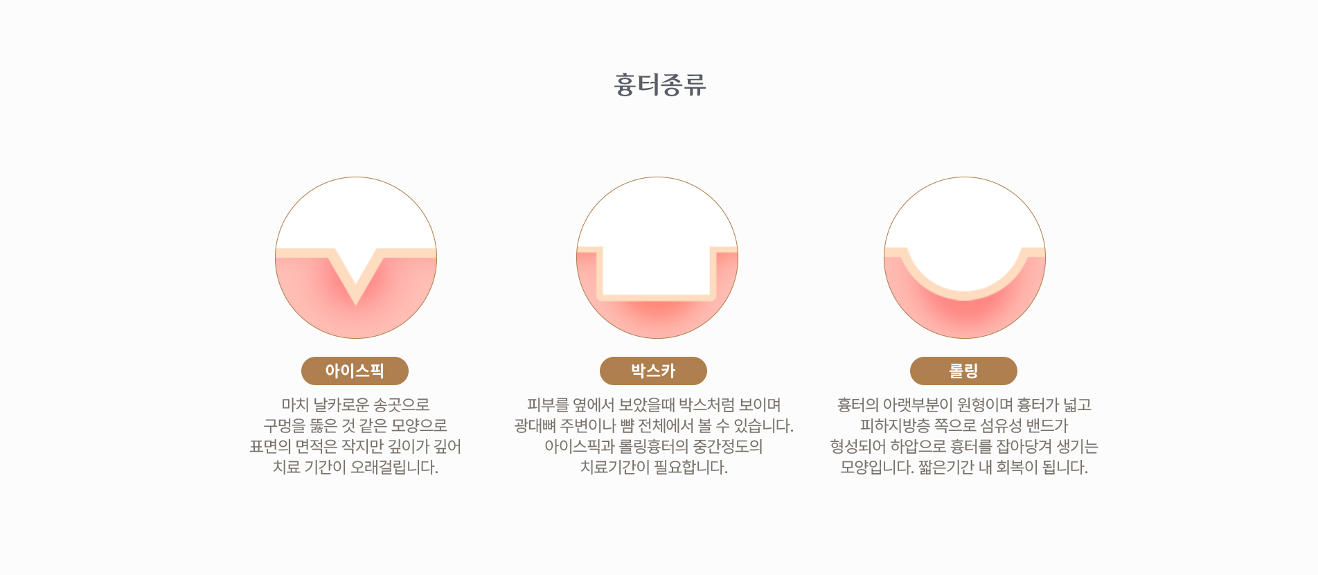 흉터종류