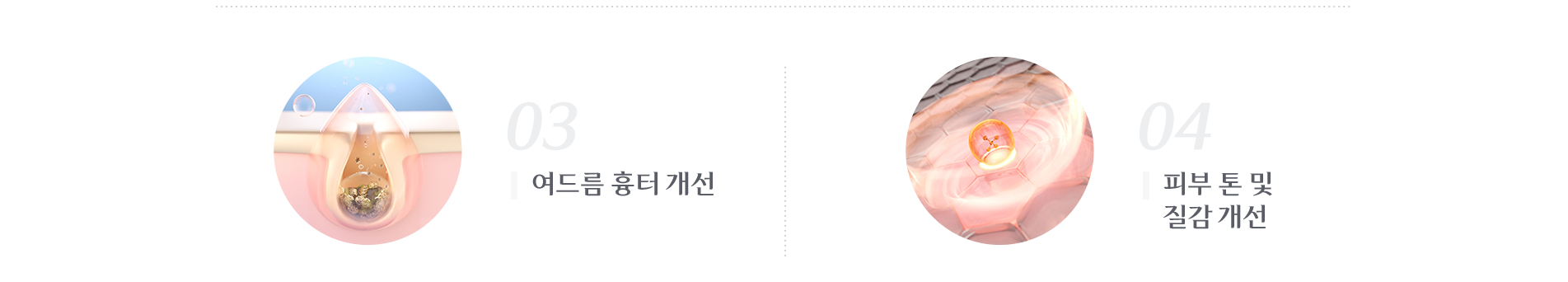 여드름 흉터개선 , 피부 톤 및 질감 개선