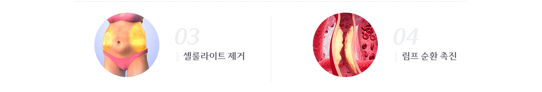 셀룰라이트 제거 , 림프 순환 촉진
