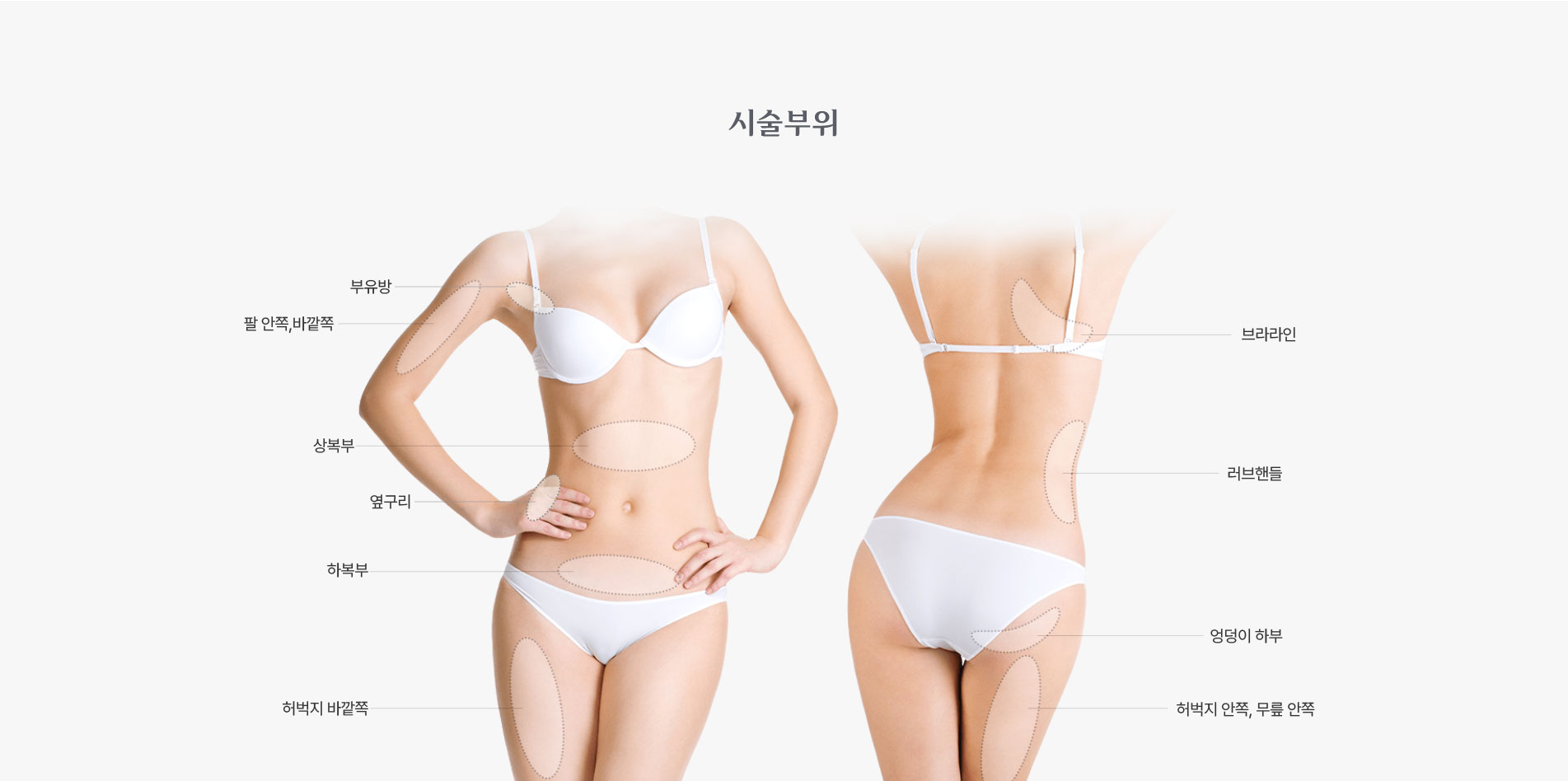 시술 부위